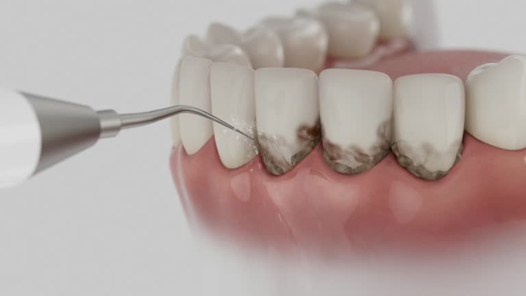Trusted Invisalign Clear Aligners service in Bryn Mawr, PA - Dentist Open Now